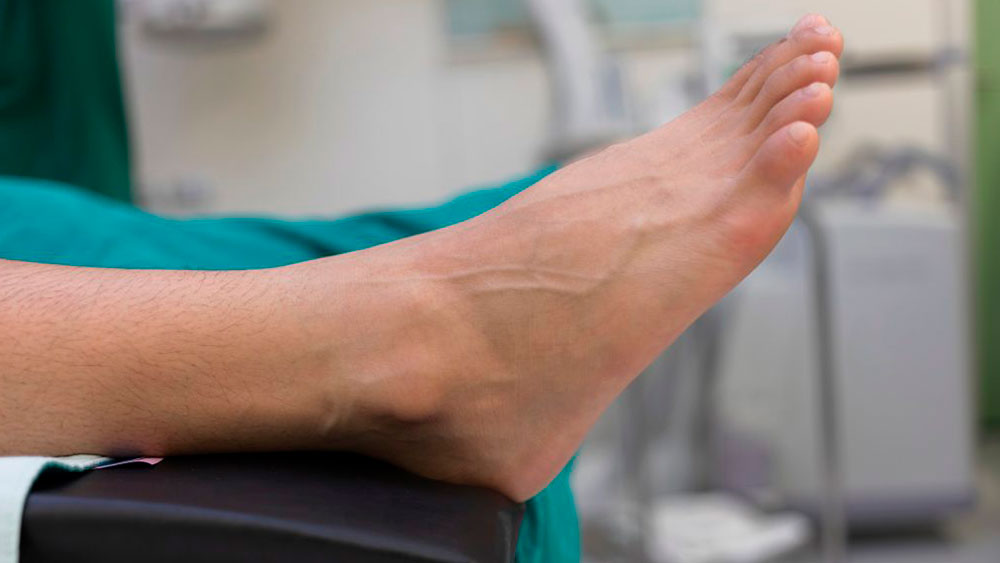 Quanto custa uma cirurgia nos pés?